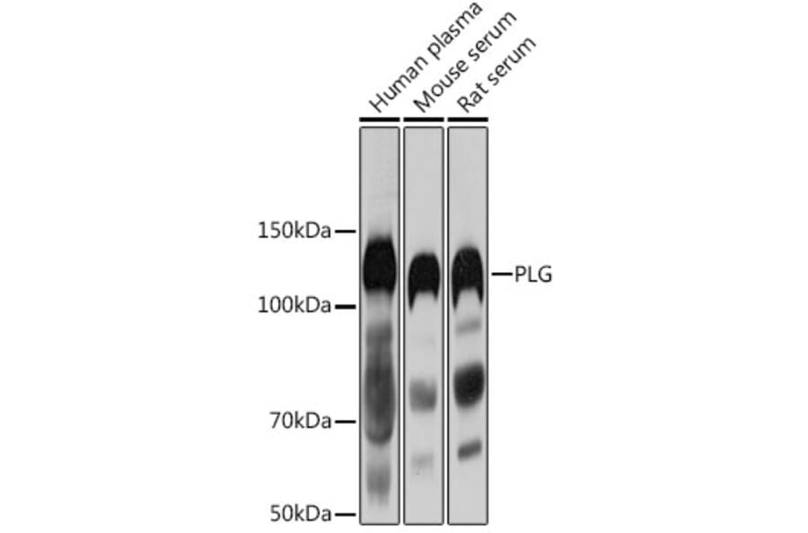 Western Blot - Anti-Plasminogen Antibody (A16840) - Antibodies.com