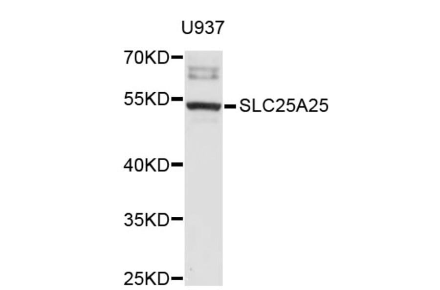 Western Blot - Anti-SLC25A25 Antibody (A3540) - Antibodies.com