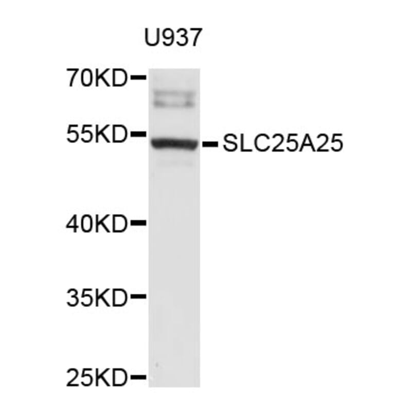 Western Blot - Anti-SLC25A25 Antibody (A3540) - Antibodies.com