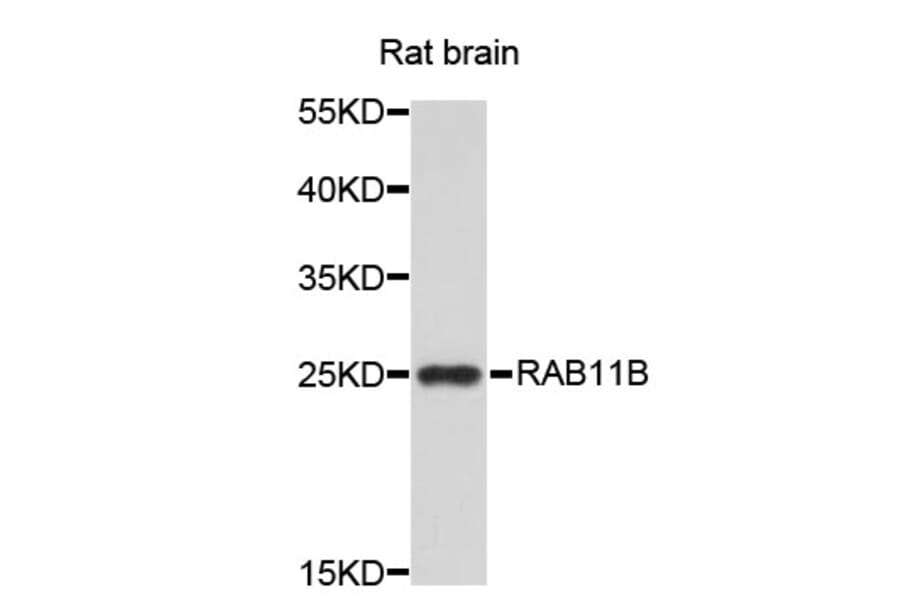 Western Blot - Anti-RAB11B Antibody (A3655) - Antibodies.com