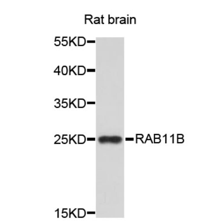 Western Blot - Anti-RAB11B Antibody (A3655) - Antibodies.com