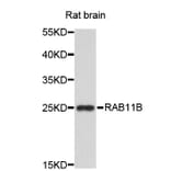 Western Blot - Anti-RAB11B Antibody (A3655) - Antibodies.com
