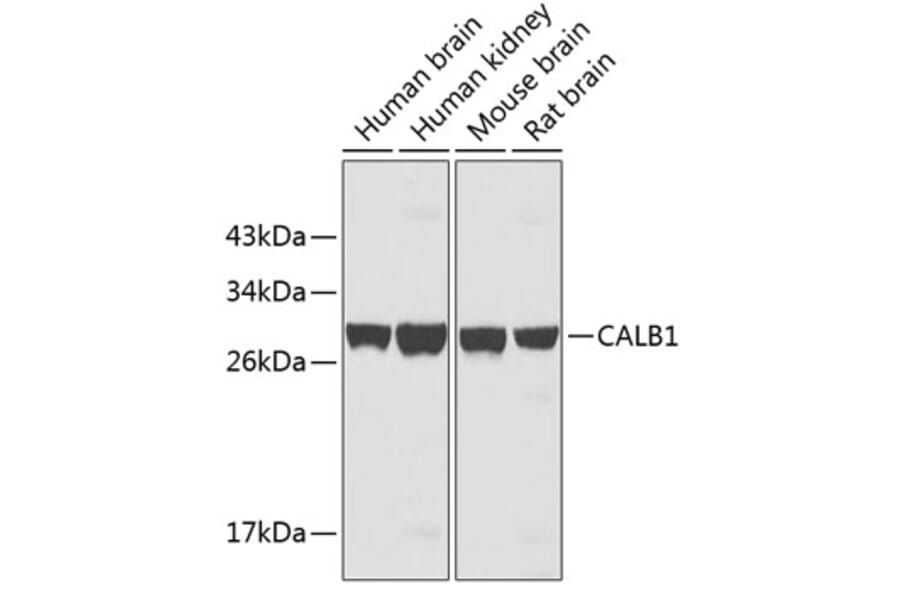 Western Blot - Anti-CALB1 Antibody (A3772) - Antibodies.com