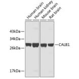 Western Blot - Anti-CALB1 Antibody (A3772) - Antibodies.com