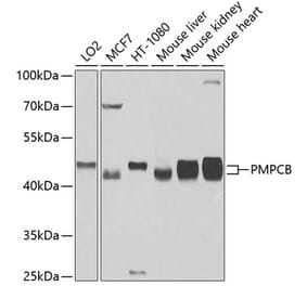 Western Blot - Anti-MPPB Antibody (A16845) - Antibodies.com
