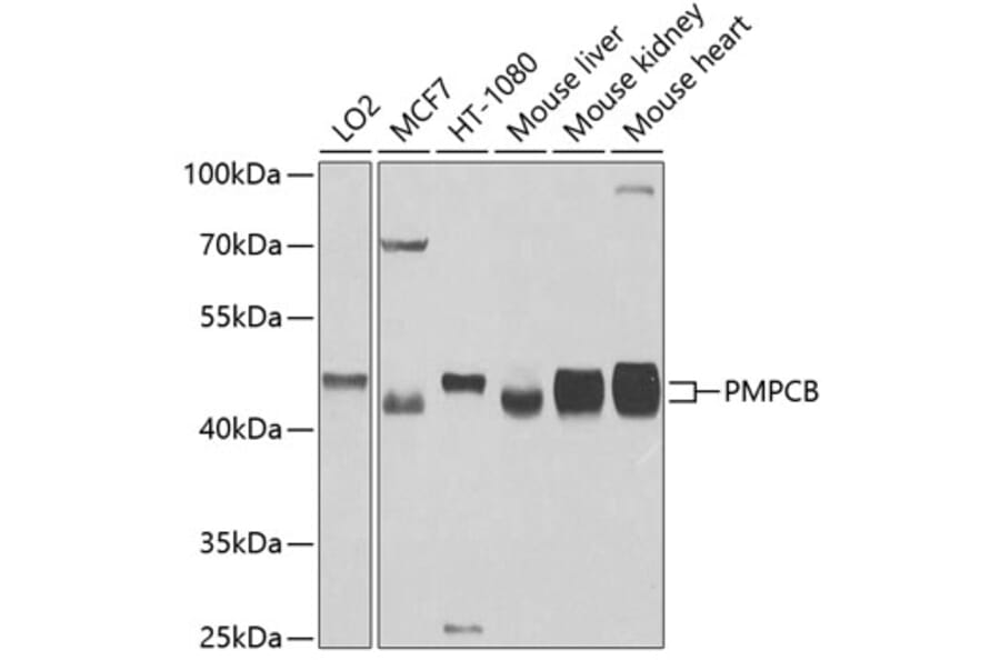 Western Blot - Anti-MPPB Antibody (A16845) - Antibodies.com