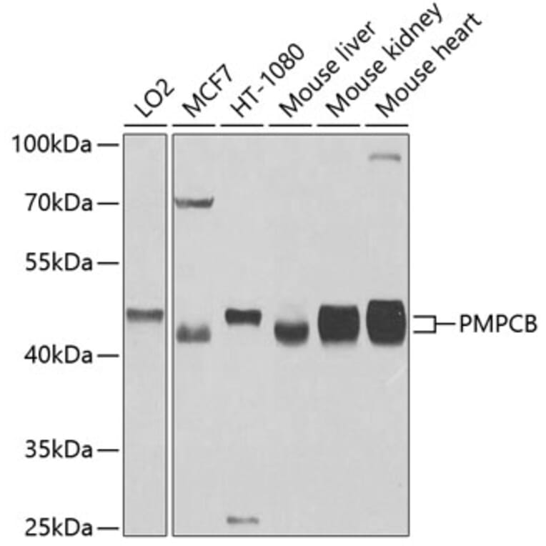 Western Blot - Anti-MPPB Antibody (A16845) - Antibodies.com