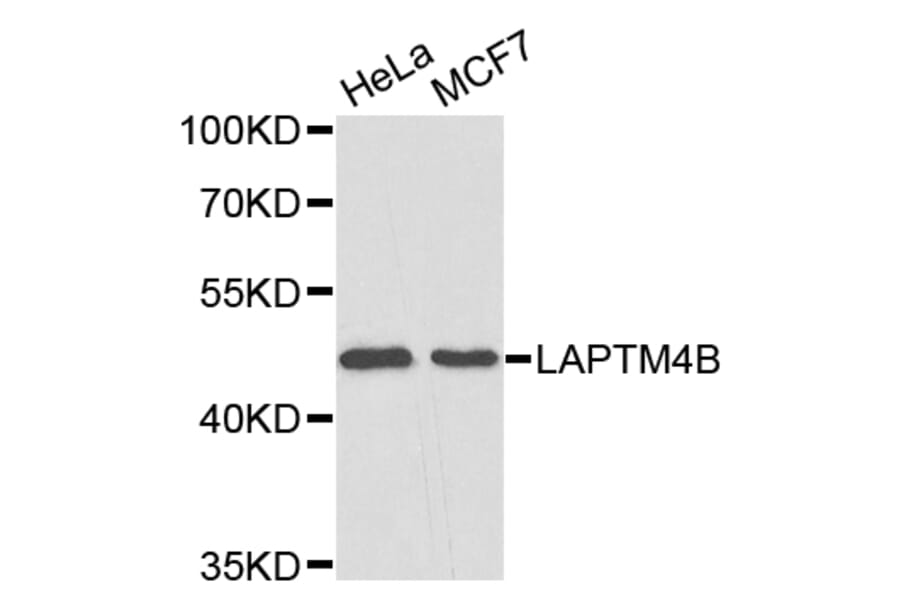 Western Blot - Anti-LAPTM4B Antibody (A4829) - Antibodies.com