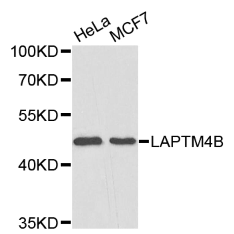 Western Blot - Anti-LAPTM4B Antibody (A4829) - Antibodies.com
