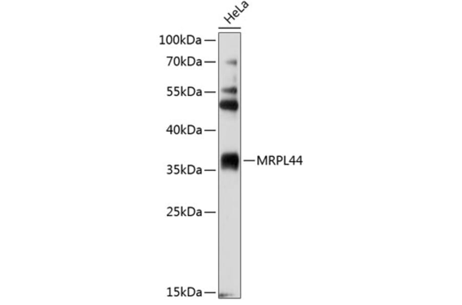 Western Blot - Anti-MRPL44 Antibody (A4949) - Antibodies.com