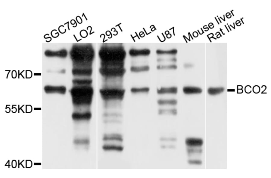 Western Blot - Anti-BCO2 Antibody (A5034) - Antibodies.com