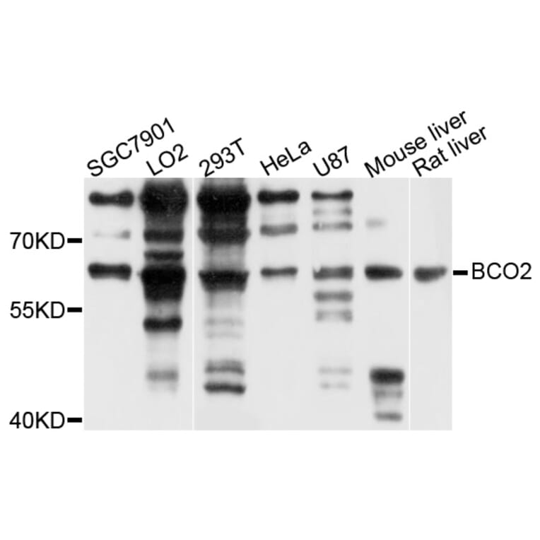 Western Blot - Anti-BCO2 Antibody (A5034) - Antibodies.com