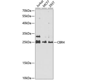 Western Blot - Anti-CBR4 Antibody (A5069) - Antibodies.com