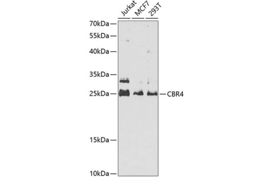 Western Blot - Anti-CBR4 Antibody (A5069) - Antibodies.com