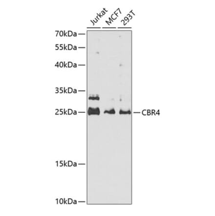 Western Blot - Anti-CBR4 Antibody (A16850) - Antibodies.com