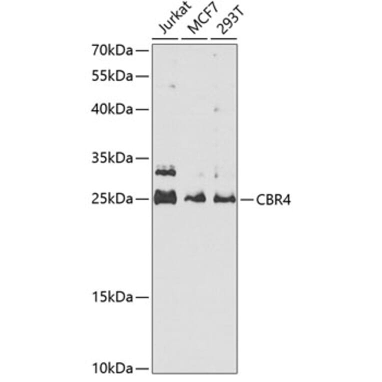 Western Blot - Anti-CBR4 Antibody (A5069) - Antibodies.com