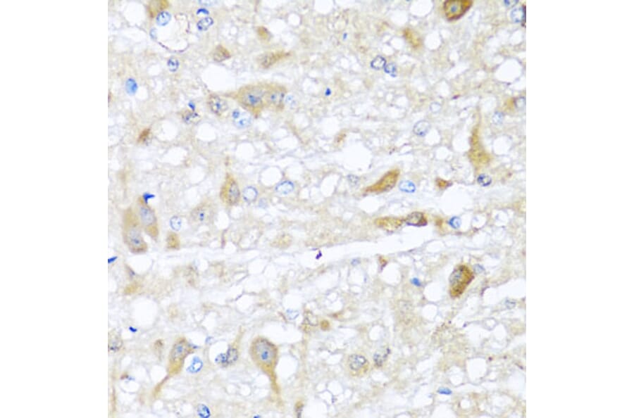 Immunohistochemistry - Anti-CBR4 Antibody (A5069) - Antibodies.com