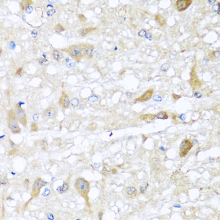 Immunohistochemistry - Anti-CBR4 Antibody (A5069) - Antibodies.com