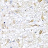 Immunohistochemistry - Anti-CBR4 Antibody (A5069) - Antibodies.com