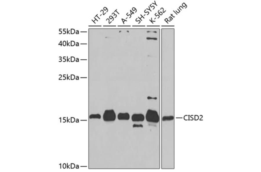Western Blot - Anti-CISD2 Antibody (A16851) - Antibodies.com