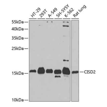 Western Blot - Anti-CISD2 Antibody (A16851) - Antibodies.com