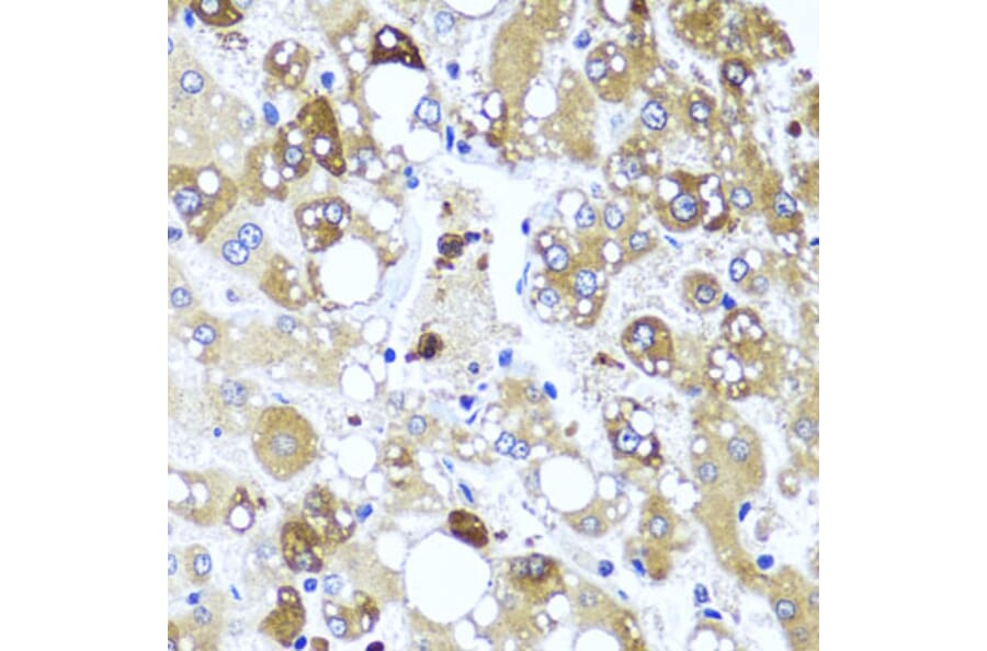 Immunohistochemistry - Anti-IL-4 Antibody (A16854) - Antibodies.com
