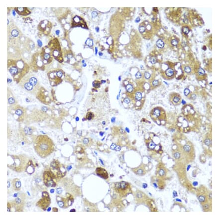 Immunohistochemistry - Anti-IL-4 Antibody (A16854) - Antibodies.com