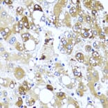 Immunohistochemistry - Anti-IL-4 Antibody (A16854) - Antibodies.com