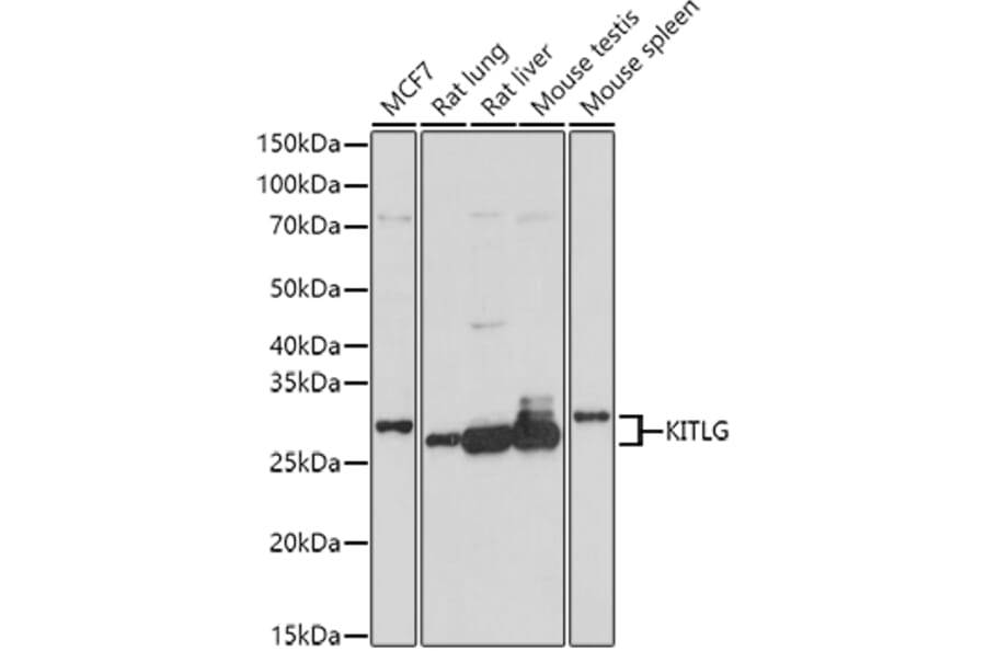 Western Blot - Anti-SCF Antibody (A16855) - Antibodies.com