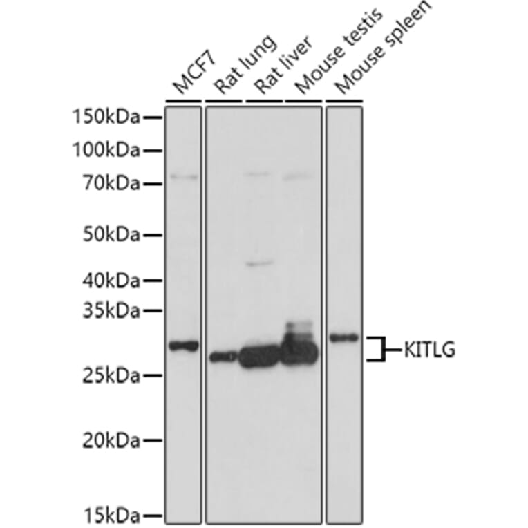 Western Blot - Anti-SCF Antibody (A16855) - Antibodies.com