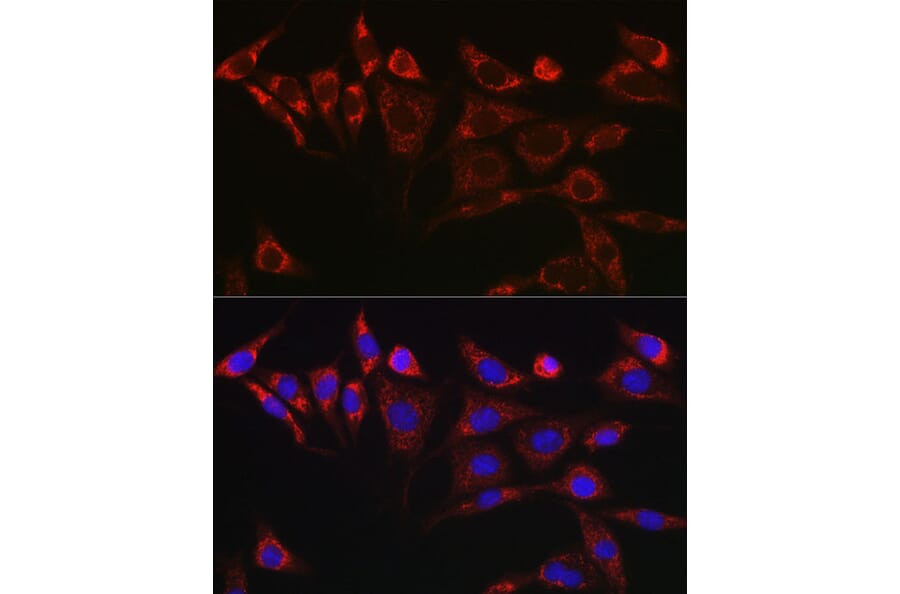 Immunofluorescence - Anti-SCF Antibody (A16855) - Antibodies.com