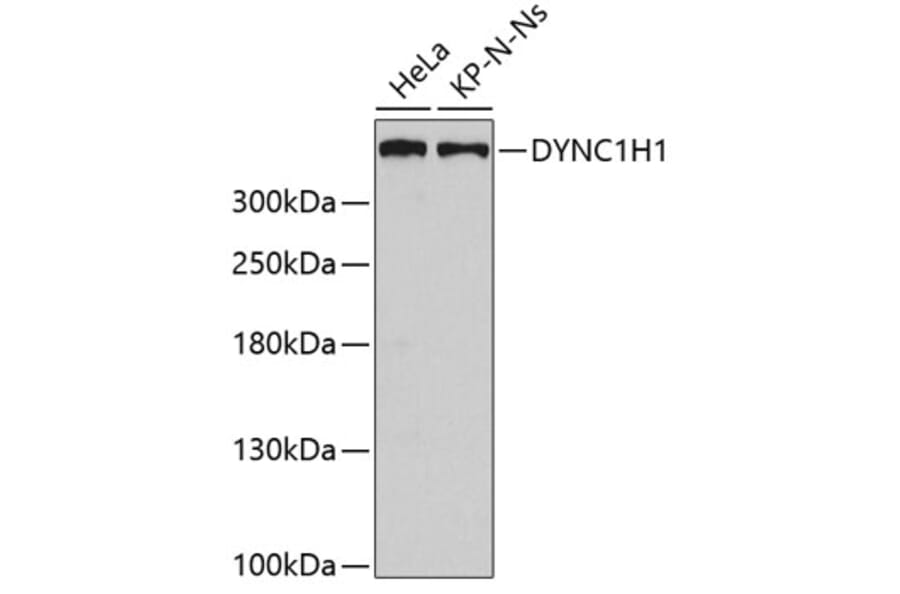 Western Blot - Anti-DYNC1H1 Antibody (A5916) - Antibodies.com