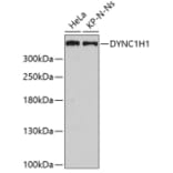 Western Blot - Anti-DYNC1H1 Antibody (A5916) - Antibodies.com