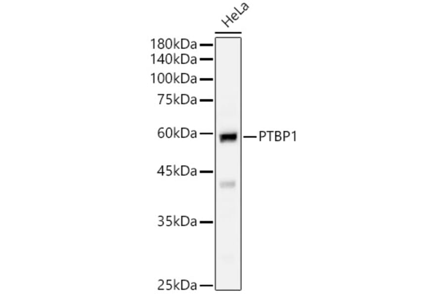 Western Blot - Anti-PTBP1 Antibody (A16859) - Antibodies.com