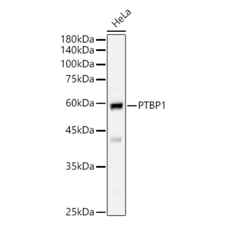 Western Blot - Anti-PTBP1 Antibody (A16859) - Antibodies.com