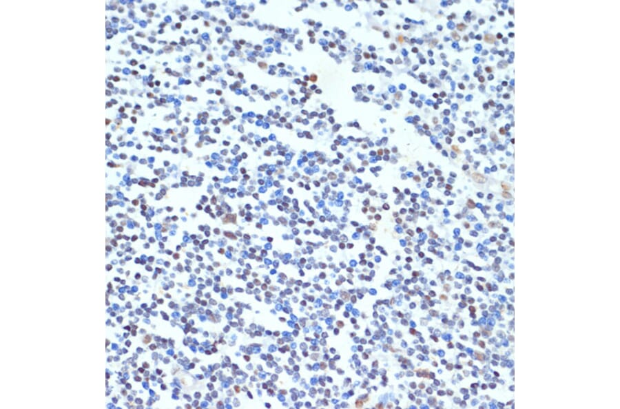 Immunohistochemistry - Anti-PTBP1 Antibody (A16859) - Antibodies.com