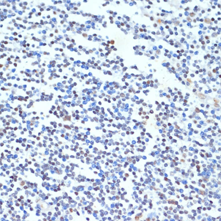 Immunohistochemistry - Anti-PTBP1 Antibody (A16859) - Antibodies.com