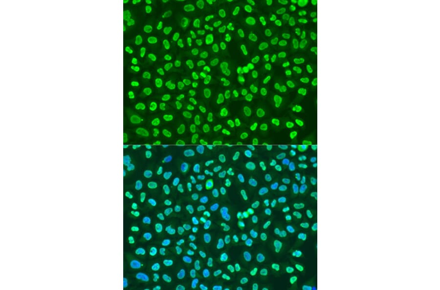 Immunofluorescence - Anti-PTBP1 Antibody (A16859) - Antibodies.com