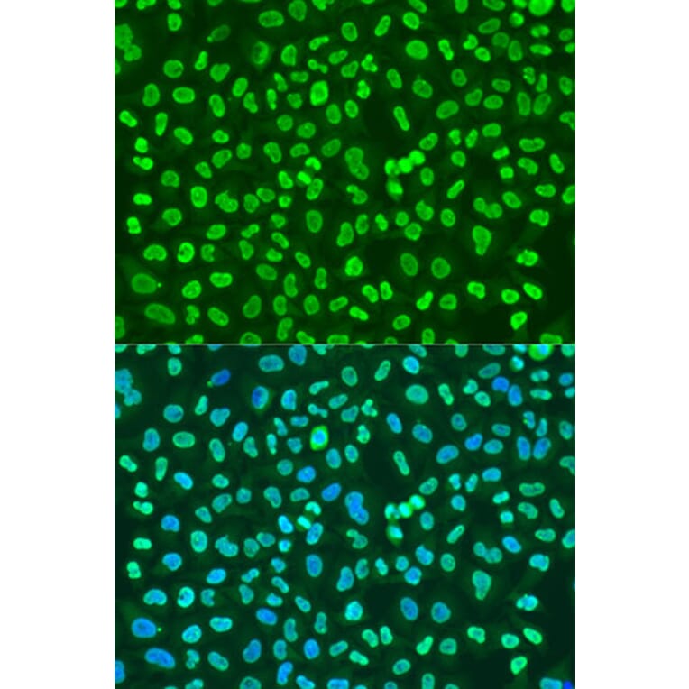 Immunofluorescence - Anti-PTBP1 Antibody (A16859) - Antibodies.com