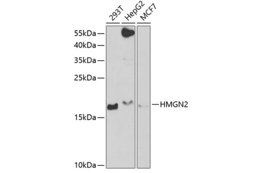Western Blot - Anti-HMGN2 Antibody (A6156) - Antibodies.com