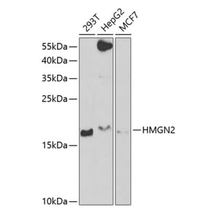 Western Blot - Anti-HMGN2 Antibody (A6156) - Antibodies.com