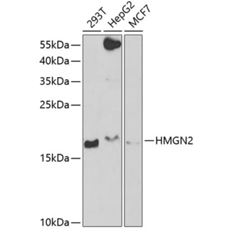 Western Blot - Anti-HMGN2 Antibody (A6156) - Antibodies.com