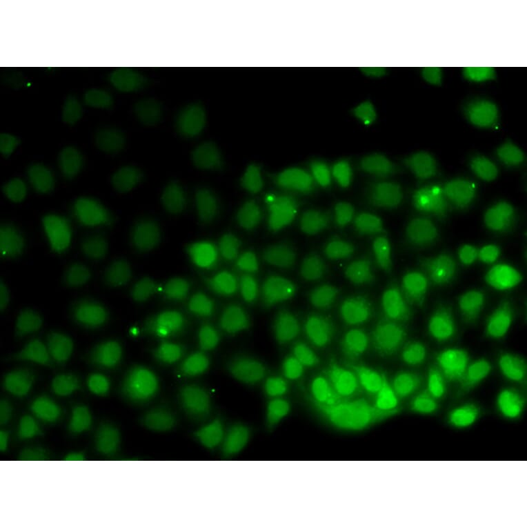 Immunofluorescence - Anti-HMGN2 Antibody (A6156) - Antibodies.com