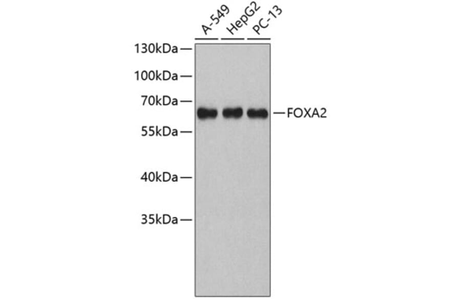 Western Blot - Anti-FOXA2 Antibody (A6189) - Antibodies.com