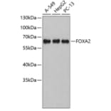 Western Blot - Anti-FOXA2 Antibody (A6189) - Antibodies.com