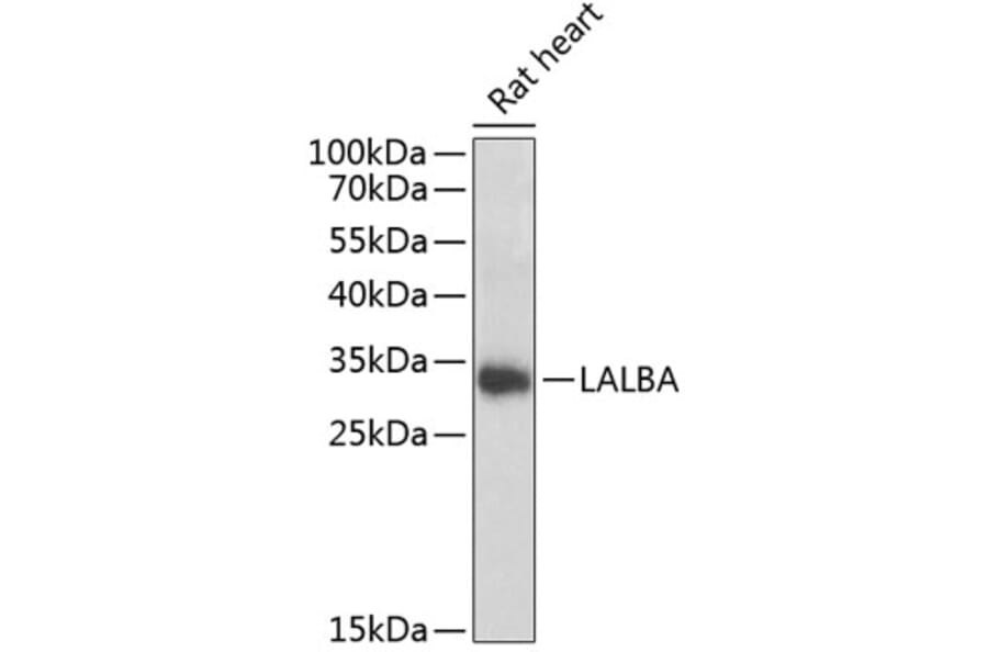Western Blot - Anti-alpha Lactalbumin Antibody (A16862) - Antibodies.com