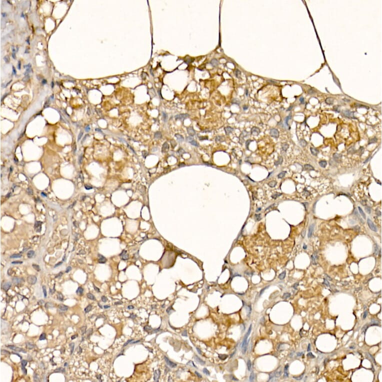 Immunohistochemistry - Anti-alpha Lactalbumin Antibody (A16862) - Antibodies.com