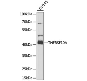 Western Blot - Anti-DR4 Antibody (A16863) - Antibodies.com