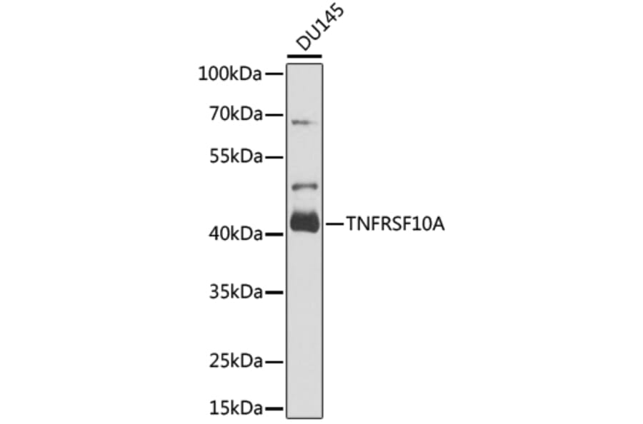 Western Blot - Anti-DR4 Antibody (A16863) - Antibodies.com