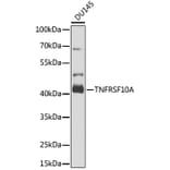 Western Blot - Anti-DR4 Antibody (A16863) - Antibodies.com